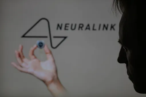 Neuralink Илона Маска получила разрешение на вживление мозгового импланта еще одному пациенту